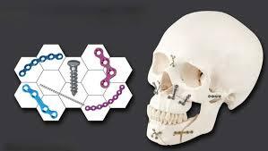 Maxillofacial Implants